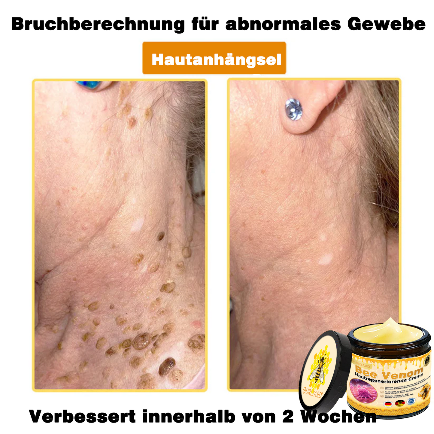 Genieße 30 % Rabatt beim Hinzufügen des zweiten Artikels 🧡