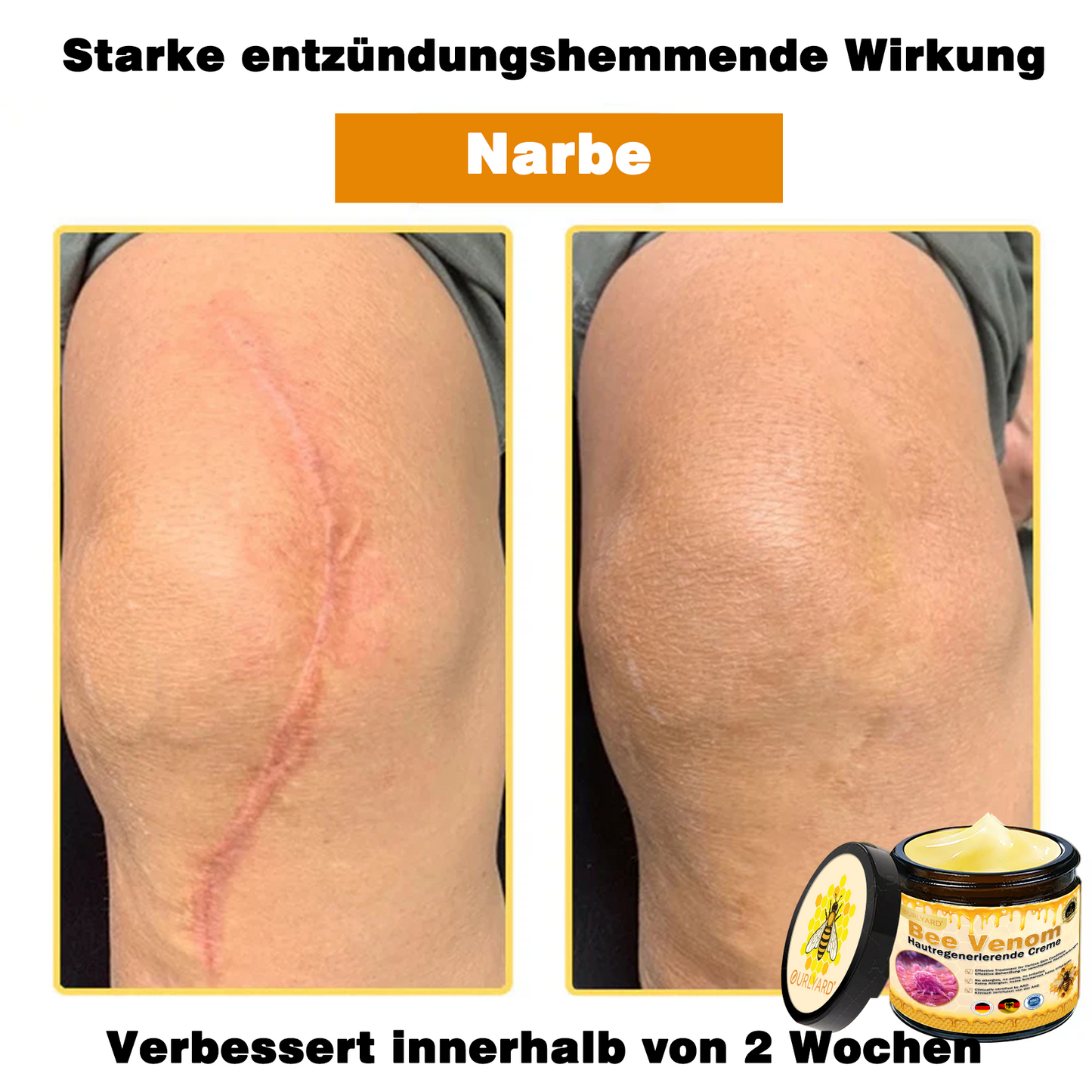 Genieße 30 % Rabatt beim Hinzufügen des zweiten Artikels 🧡